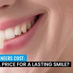 dental-veneers-cost