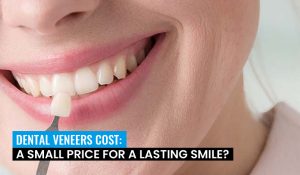 dental-veneers-cost