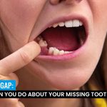 missing-tooth
