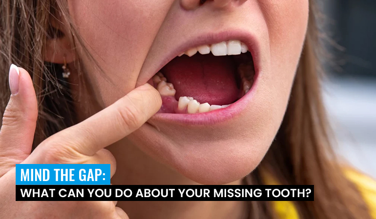 missing-tooth