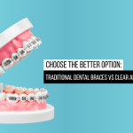 Dental-Braces