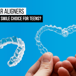 clear-aligners