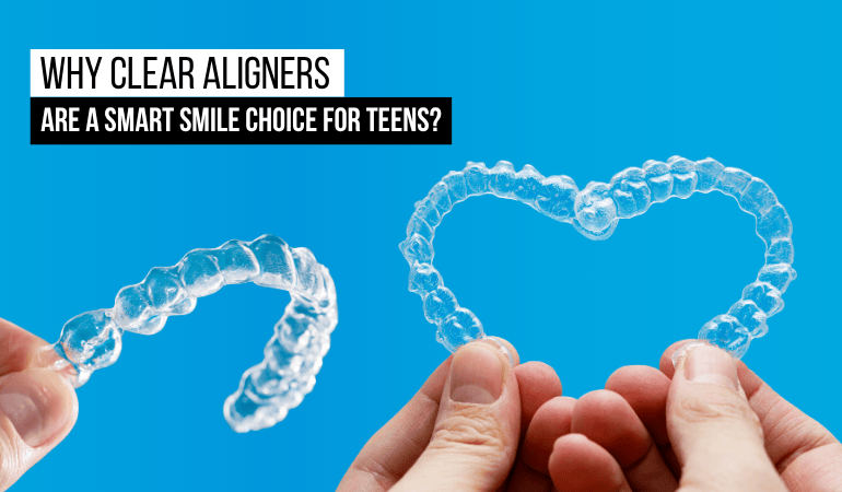 clear-aligners