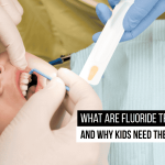 fluoride-treatments