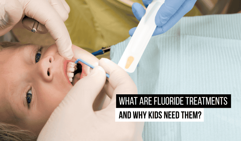 fluoride-treatments