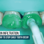 icon-resin-infiltration