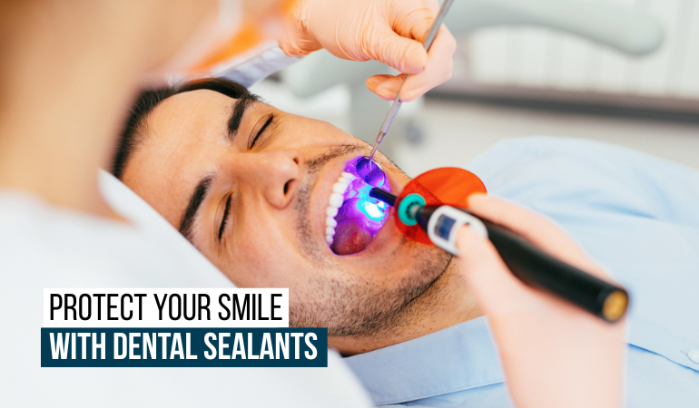 Dental-Sealants