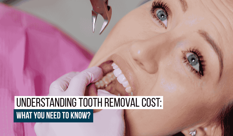 Tooth-Removal-Cost