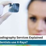 Preferred-Dental-Care-Dentist-use-X-Rays-for-dental-treatments
