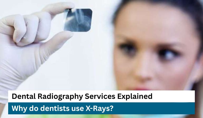 Preferred-Dental-Care-Dentist-use-X-Rays-for-dental-treatments