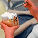 Dental-Restoration-Services