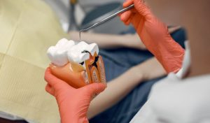 Dental-Restoration-Services