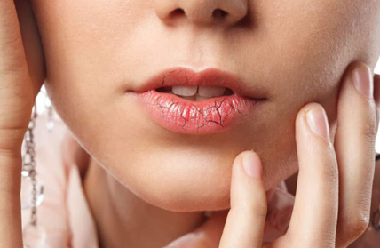 dry mouth