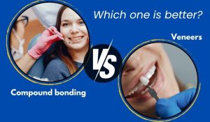 Compound-bonding-PDC