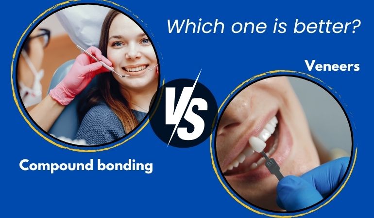 Compound-bonding-PDC
