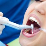 Dental-Restoration-Services-in-Davie
