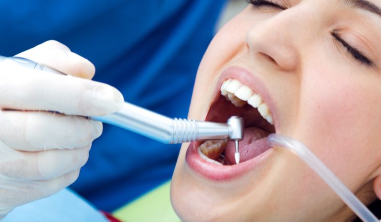 Dental-Restoration-Services-in-Davie