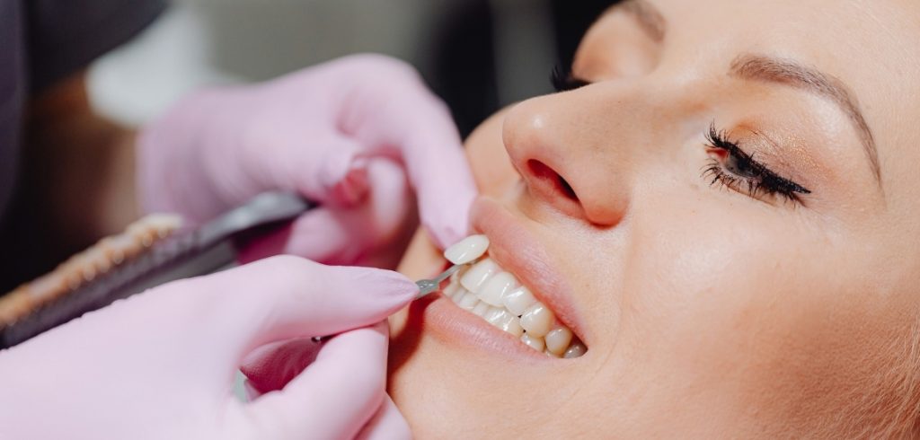 Dental-care-treatment